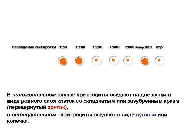 В положительном случае эритроциты оседают на дне лунки в виде ровного слоя клеток со