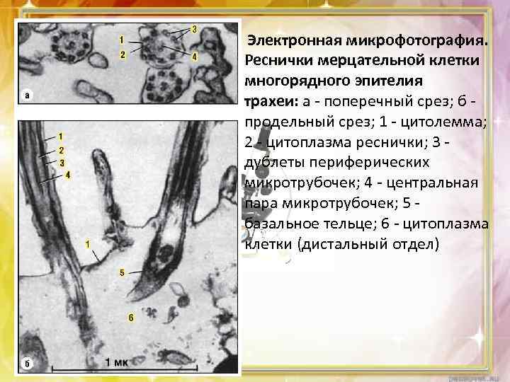  Электронная микрофотография. Реснички мерцательной клетки многорядного эпителия трахеи: а - поперечный срез; б