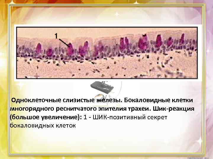 На рисунке под каким номером изображен реснитчатый эпителий