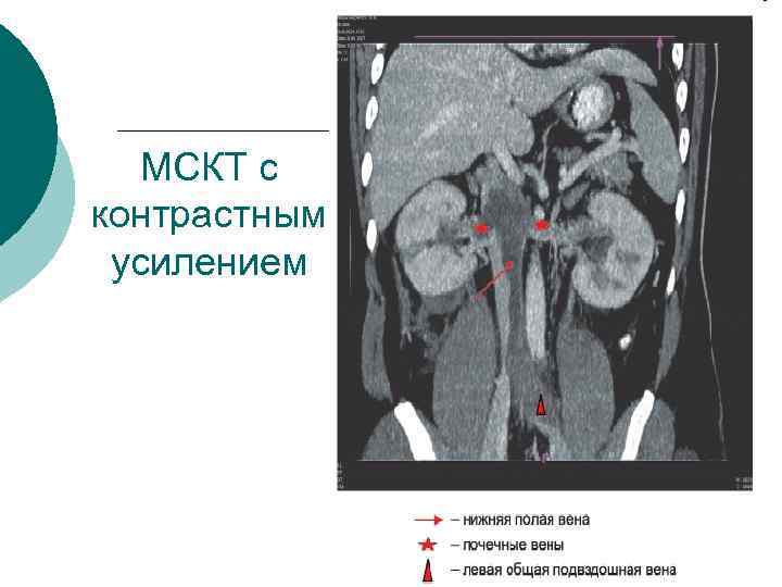 МСКТ с контрастным усилением 