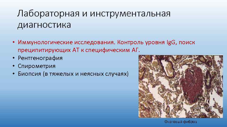 Лабораторная и инструментальная диагностика • Иммунологические исследования. Контроль уровня Ig. G, поиск преципитирующих АТ