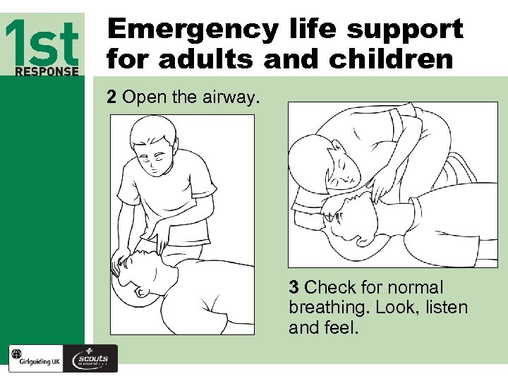 Emergency life support for adults and children 2 Open the airway. 3 Check for