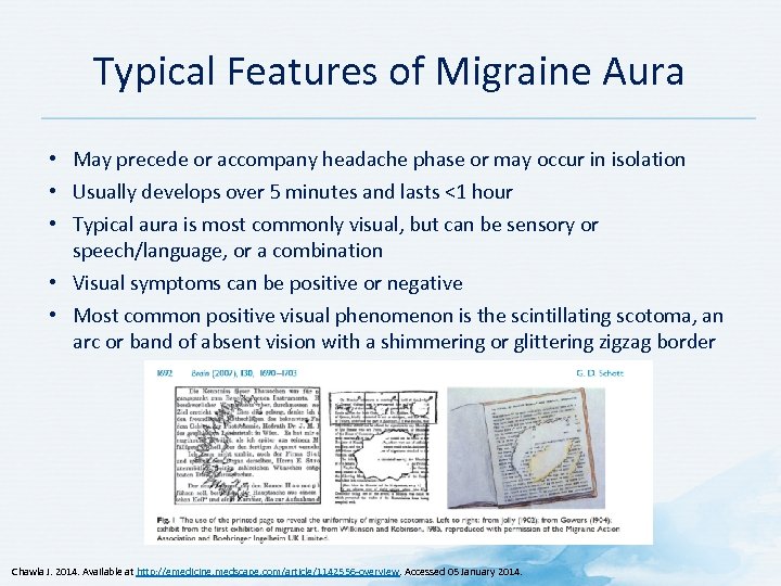 Typical Features of Migraine Aura • May precede or accompany headache phase or may