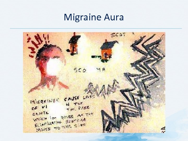 Migraine Aura 