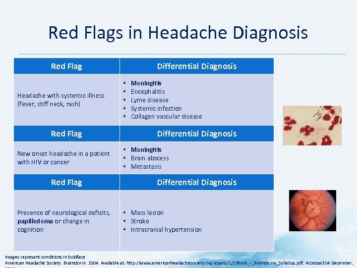 Red Flags in Headache Diagnosis Red Flag Headache with systemic illness (fever, stiff neck,