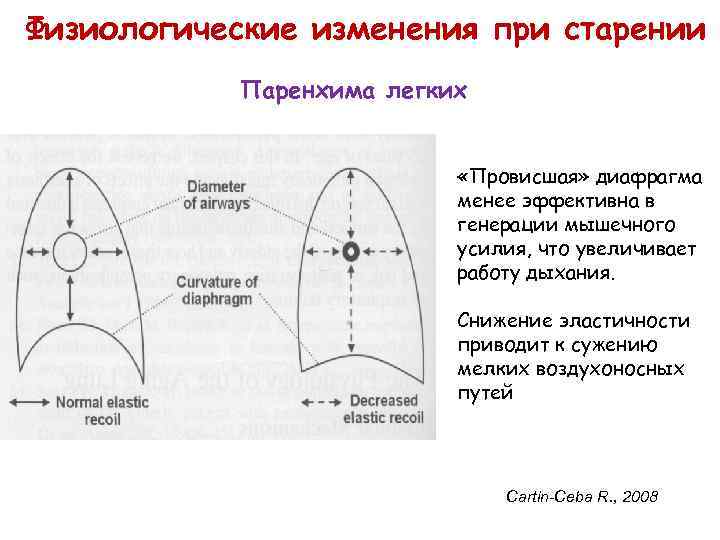 Физиологические изменения при старении Паренхима легких «Провисшая» диафрагма менее эффективна в генерации мышечного усилия,