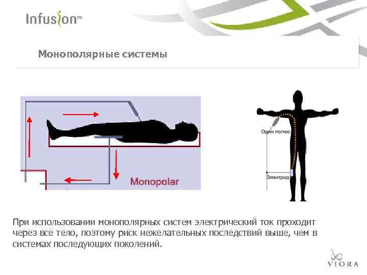Монополярные системы При использовании монополярных систем электрический ток проходит через все тело, поэтому риск