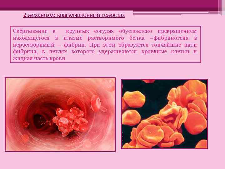 2 механизм: коагуляционный гемостаз Свёртывание в крупных сосудах обусловлено превращением находящегося в плазме растворимого