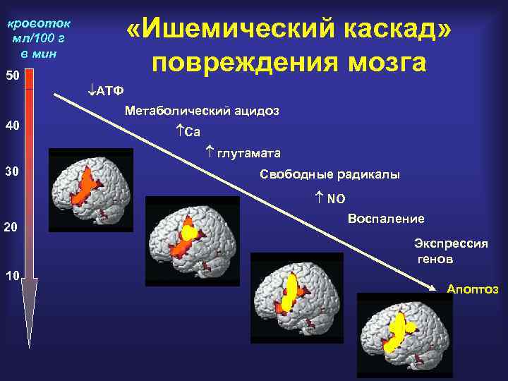  «Ишемический каскад» повреждения мозга кровоток мл/100 г в мин 50 АТФ Метаболический ацидоз