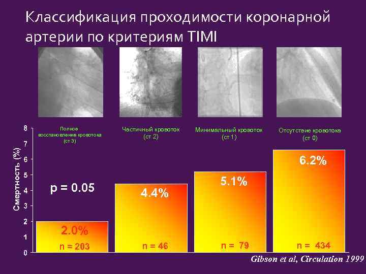 Классификация проходимости коронарной артерии по критериям TIMI Смертность (%) Полное восстановление кровотока (ст 3)