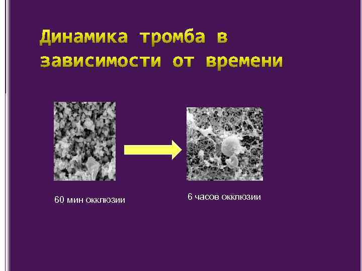 60 мин окклюзии 6 часов окклюзии 