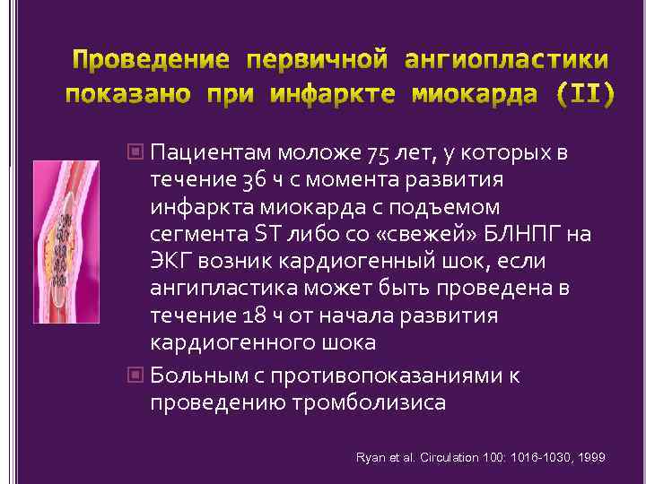  Пациентам моложе 75 лет, у которых в течение 36 ч с момента развития