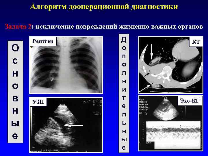 Алгоритм дооперационной диагностики Задача 2: исключение повреждений жизненно важных органов О с н о