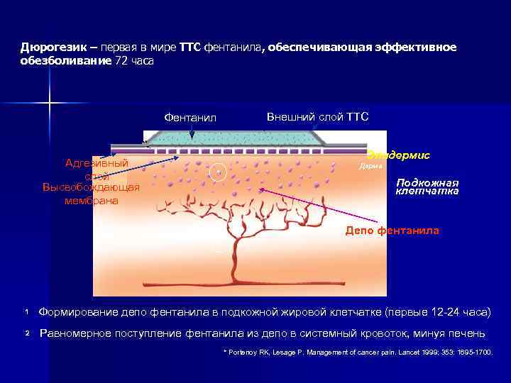 Дюрогезик – первая в мире ТТС фентанила, обеспечивающая эффективное обезболивание 72 часа Внешний слой