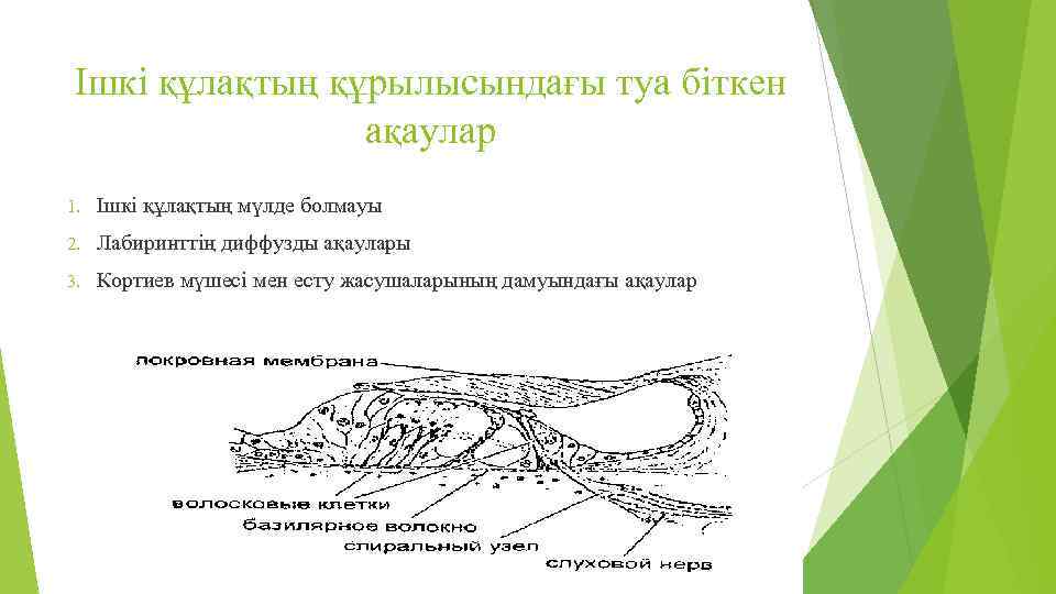 Ішкі құлақтың құрылысындағы туа біткен ақаулар 1. Ішкі құлақтың мүлде болмауы 2. Лабиринттің диффузды