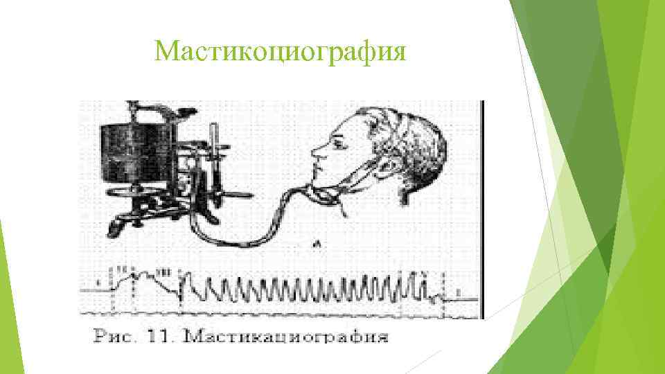 Мастикоциография 