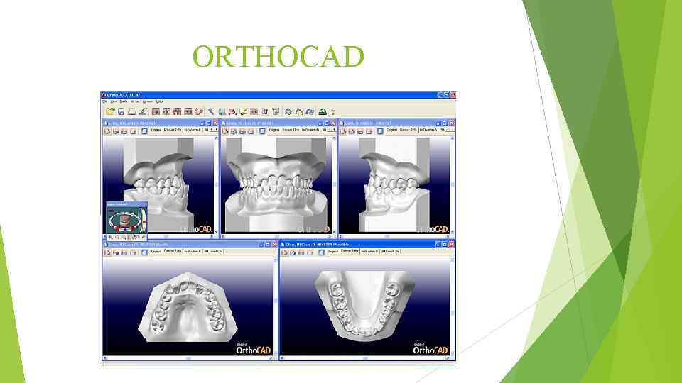 ORTHOCAD 