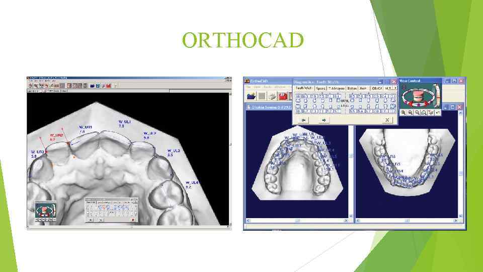 ORTHOCAD 