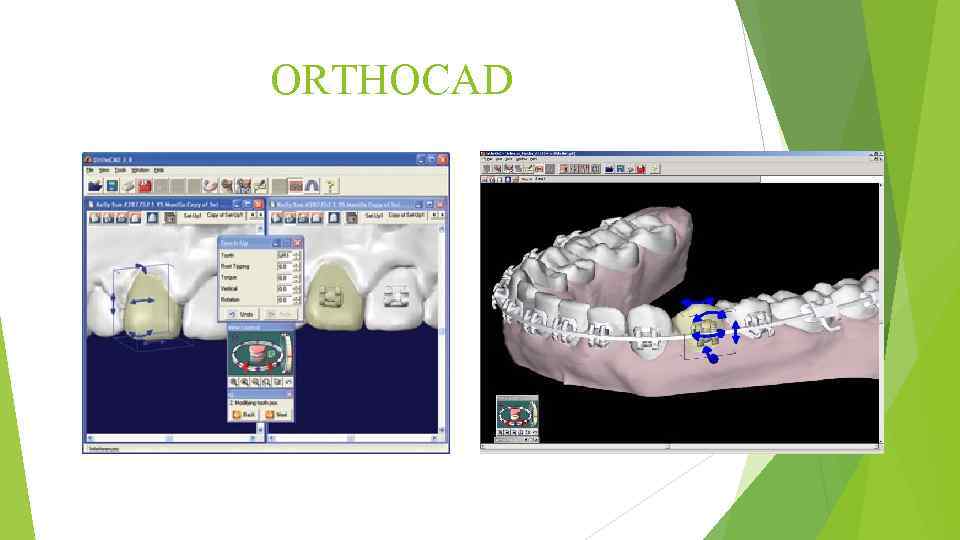 ORTHOCAD 