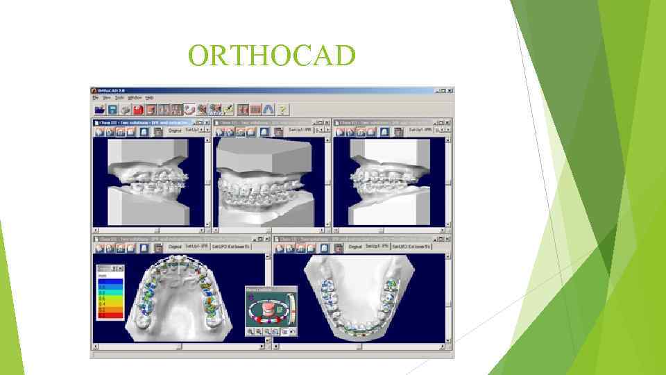 ORTHOCAD 