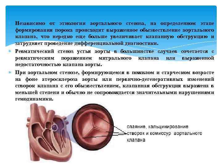  Независимо от этиологии аортального стеноза, на определенном этапе формирования порока происходит выраженное обызвествление
