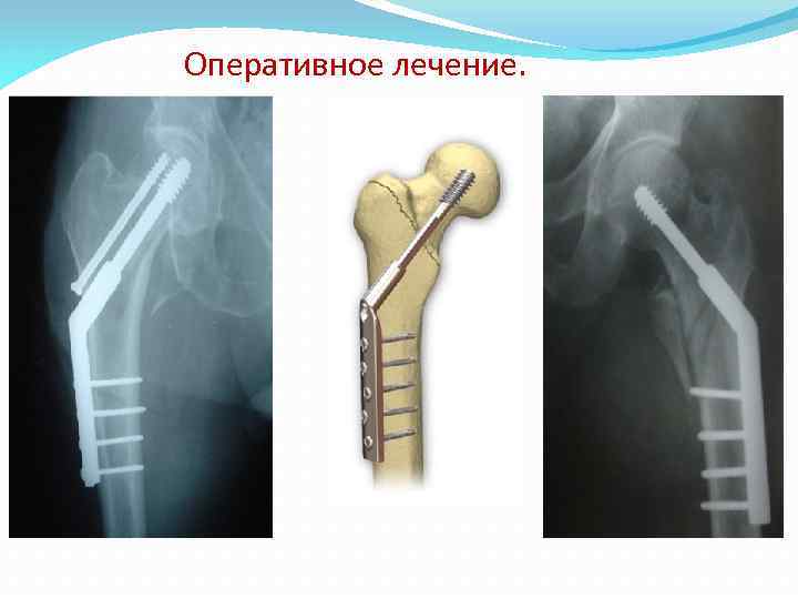 Оперативное лечение. 