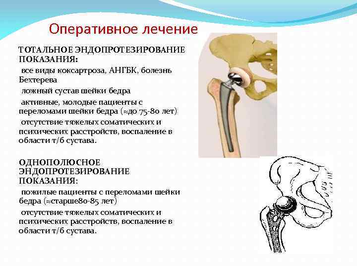 Перелом шейки бедра эндопротезирование тазобедренного сустава. Эндопротез плечевого сустава Тотальный реверсивный. Показания для тотального эндопротезирования тазобедренного сустава. Субкапитальный перелом бедренной кости.