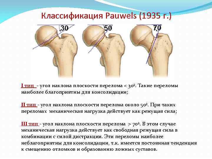 Ответы на тест нмо перелом проксимального отдела