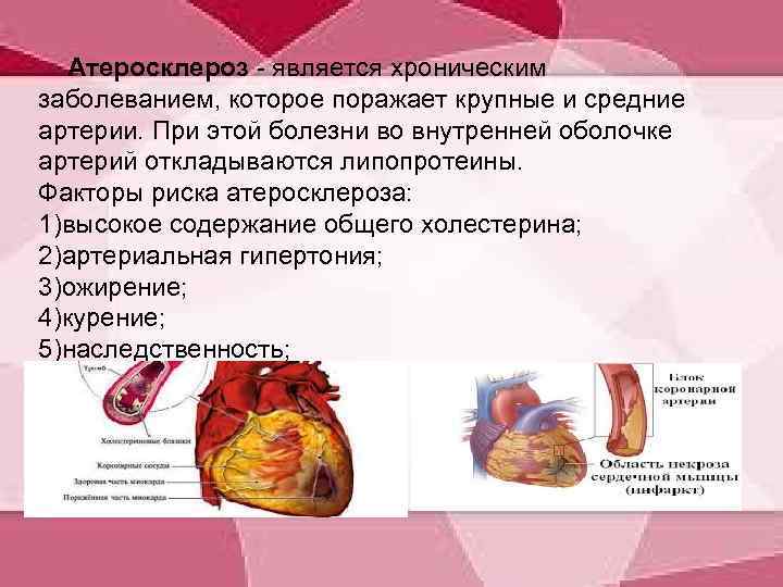  Атеросклероз - является хроническим заболеванием, которое поражает крупные и средние артерии. При этой