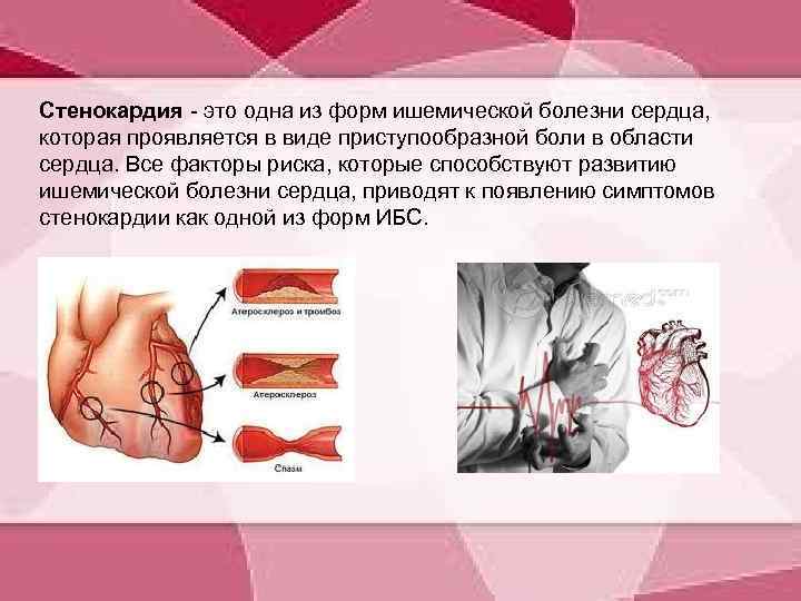 Стенокардия - это одна из форм ишемической болезни сердца, которая проявляется в виде приступообразной