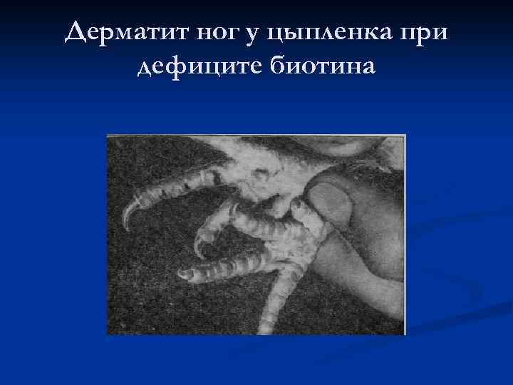 Дерматит ног у цыпленка при дефиците биотина 