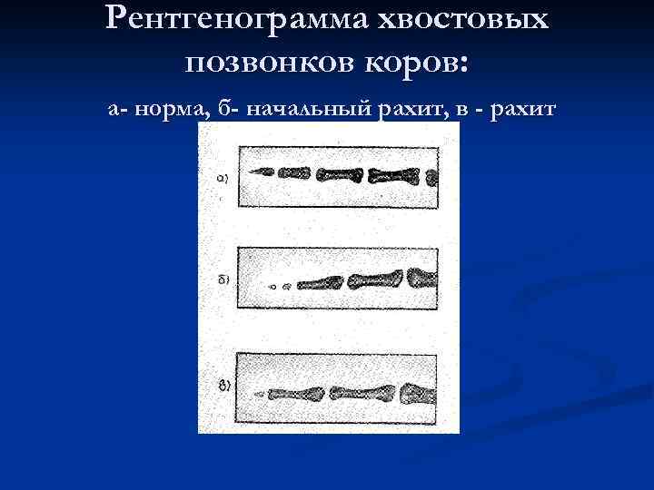 Рентгенограмма хвостовых позвонков коров: а- норма, б- начальный рахит, в - рахит 