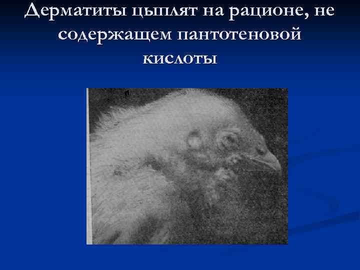 Дерматиты цыплят на рационе, не содержащем пантотеновой кислоты 