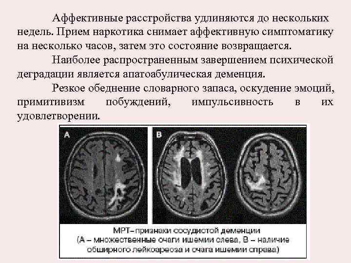 Аффективные расстройства удлиняются до нескольких недель. Прием наркотика снимает аффективную симптоматику на несколько часов,