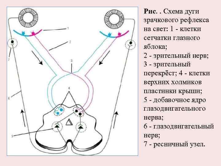 Рис. . Схема дуги зрачкового рефлекса на свет: 1 - клетки сетчатки глазного яблока;