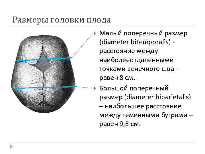 Размеры головки таза. Размеры головки плода. Размеры головки плода в акушерстве. Большой и малый поперечный размер головки плода. Нормальные Размеры головы у плода.