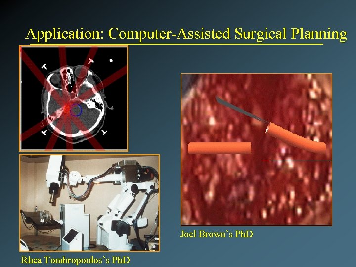 Application: Computer-Assisted Surgical Planning Joel Brown’s Ph. D Rhea Tombropoulos’s Ph. D 