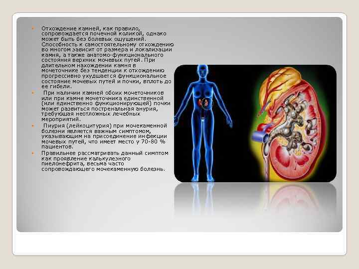  Отхождение камней, как правило, сопровождается почечной коликой, однако может быть без болевых ощущений.