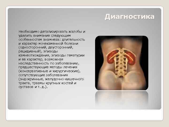 Диагностика Необходимо детализировать жалобы и уделить внимание следующим особенностям анамнеза: длительность и характер мочекаменной