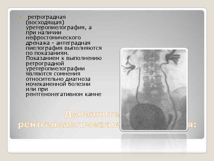  ретроградная (восходящая) уретеропиелография, а при наличии нефростомического дренажа - антеградная пиелография выполняются по