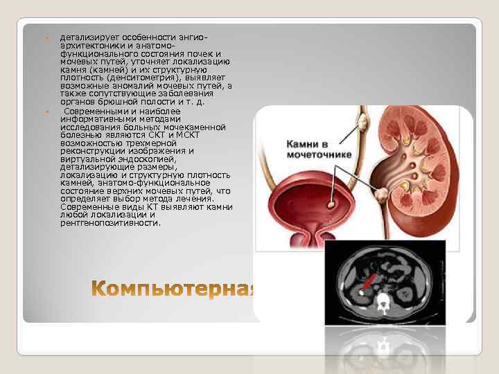  детализирует особенности ангиоархитектоники и анатомофункционального состояния почек и мочевых путей, уточняет локализацию камня