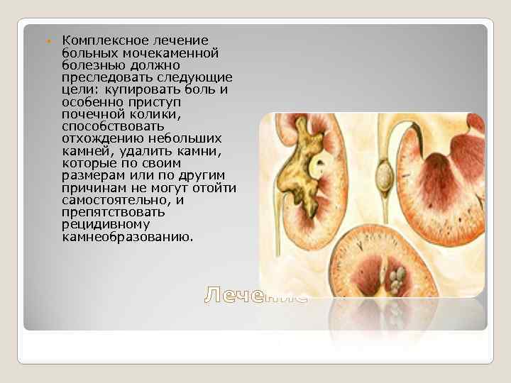  Комплексное лечение больных мочекаменной болезнью должно преследовать следующие цели: купировать боль и особенно