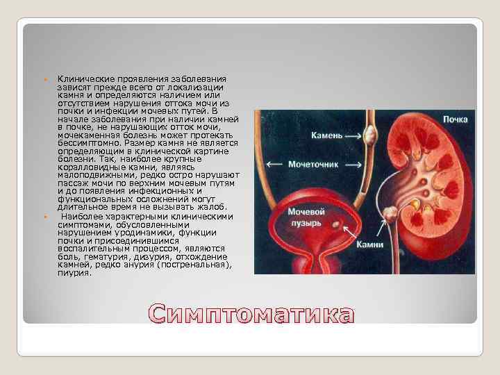  Клинические проявления заболевания зависят прежде всего от локализации камня и определяются наличием или