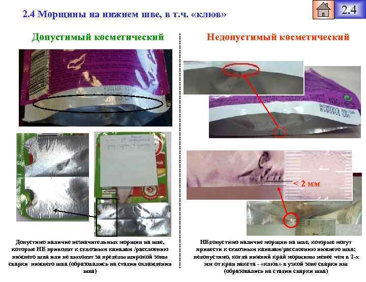 2. 4 Морщины на нижнем шве, в т. ч. «клюв» Допустимый косметический Недопустимый косметический