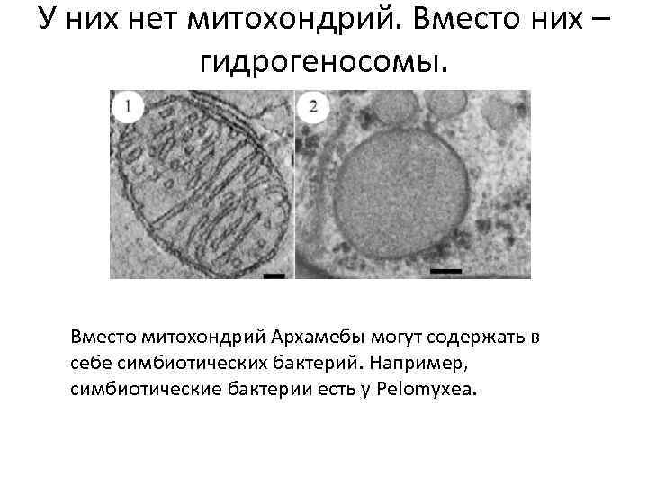 У них нет митохондрий. Вместо них – гидрогеносомы. Вместо митохондрий Архамебы могут содержать в