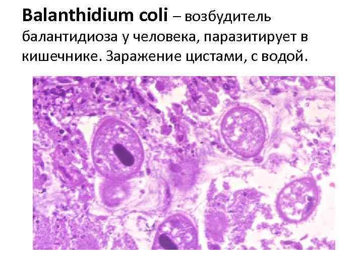 Balanthidium coli – возбудитель балантидиоза у человека, паразитирует в кишечнике. Заражение цистами, с водой.