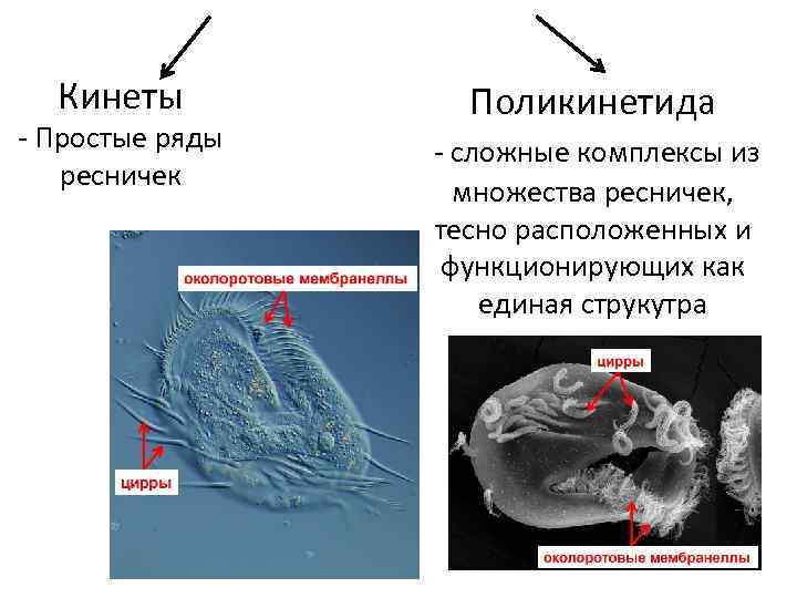 Кинеты - Простые ряды ресничек Поликинетида - сложные комплексы из множества ресничек, тесно расположенных