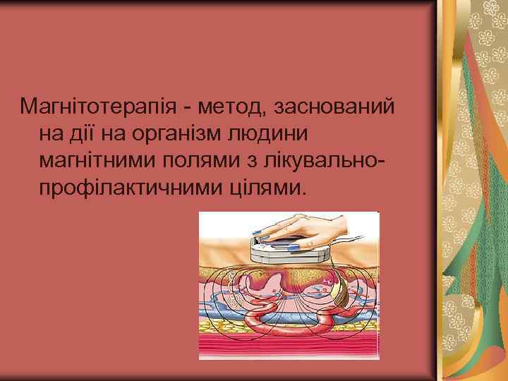 Магнітотерапія - метод, заснований на дії на організм людини магнітними полями з лікувальнопрофілактичними цілями.