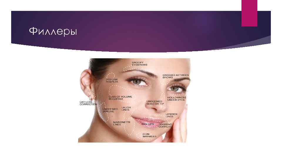 Филлеры 