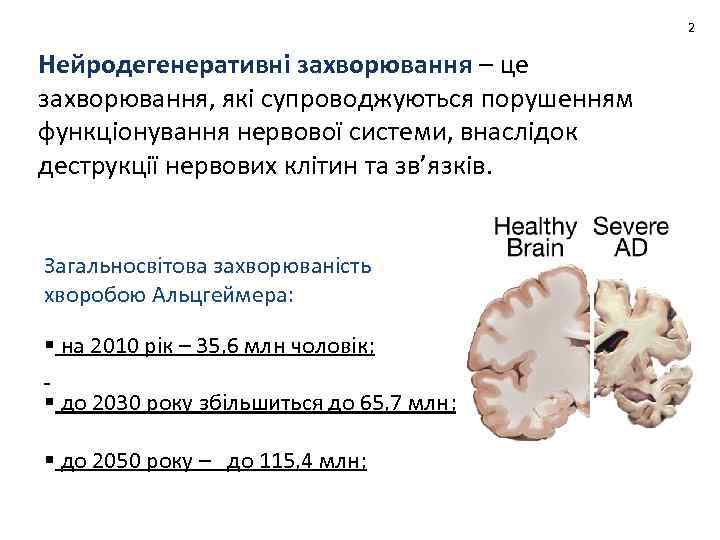 2 Нейродегенеративні захворювання – це захворювання, які супроводжуються порушенням функціонування нервової системи, внаслідок деструкції